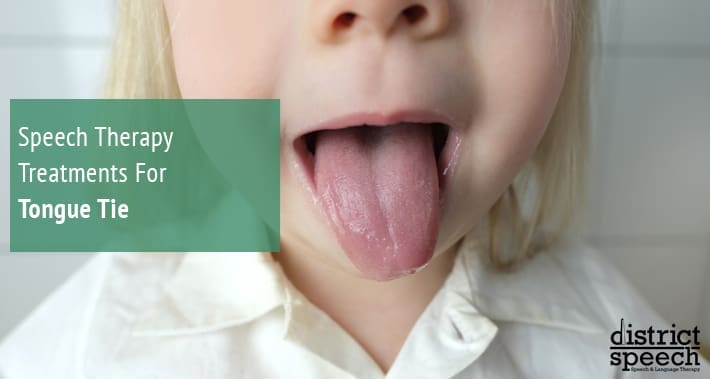 Speech Therapy Treatments For Tongue Tie | District Speech & Language Therapy | Washington D.C. & Arlington VA